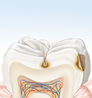 Sem medidas de higiene oral melhoradas e adequadas